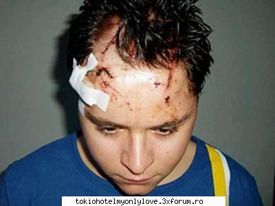 tobosarul tokio hotel, dus urgenta spital gustav schaefer varsta doar ani, fost ranit the club din